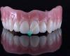 AboutSmile Dentures