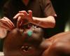 Acupuncture For Athletes