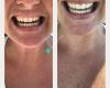 Atlantic Teeth Whitening
