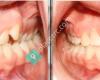 Braces by Dr. Emily Hung, DDS, M