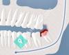 Brisman Implant and Oral Surgery