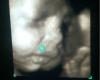 Candelight Fetal Photos, LLC