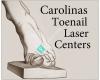 Carolinas Toenail Laser Centers