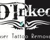 D' Inked Laser Tattoo Removal