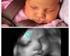 Fetal Memories 2D 3D 4D Ultrasound