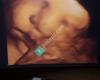 Houston Babies 4d Ultrasound