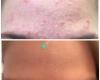 Noy Skincare + Laser