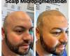 Parascalpmicro Scalp Micropigmentation & Microblading
