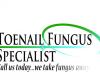 Toenail Fungus Specialist