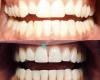 Upland Dental Implant & Orthodontics