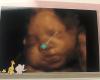 Video Prenatal 3D 4D Ultrasound